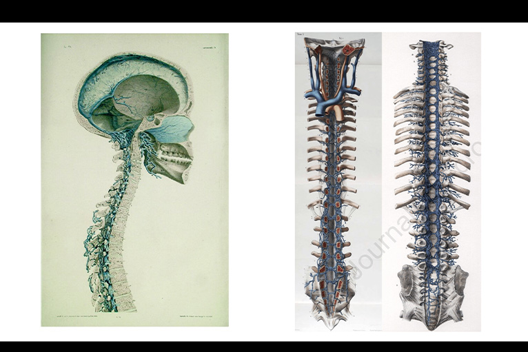 CEREBROSPINAL VENOUS SYSTEM